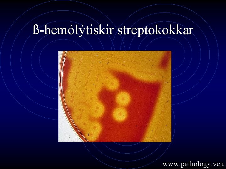 ß-hemólýtiskir streptokokkar www. pathology. vcu 