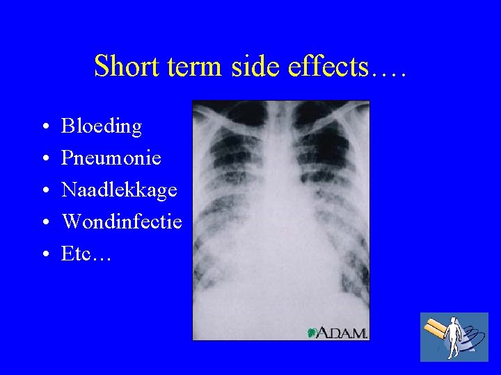 Short term side effects…. • • • Bloeding Pneumonie Naadlekkage Wondinfectie Etc… 