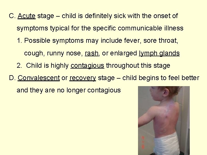 C. Acute stage – child is definitely sick with the onset of symptoms typical