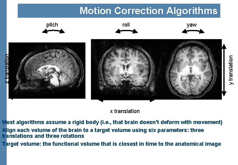 Motion Correction Algorithms roll yaw y translation z translation pitch x translation Most algorithms