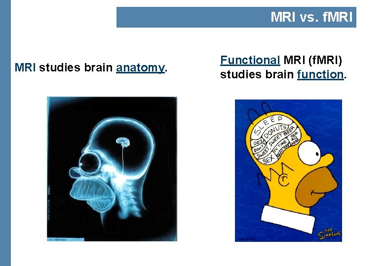 MRI vs. f. MRI studies brain anatomy. Functional MRI (f. MRI) studies brain function.