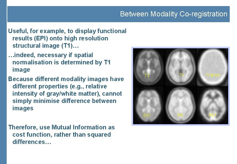 Between Modality Co-registration Useful, for example, to display functional results (EPI) onto high resolution