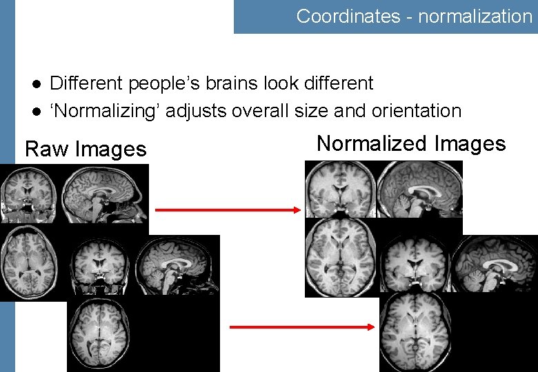 Coordinates - normalization l l Different people’s brains look different ‘Normalizing’ adjusts overall size