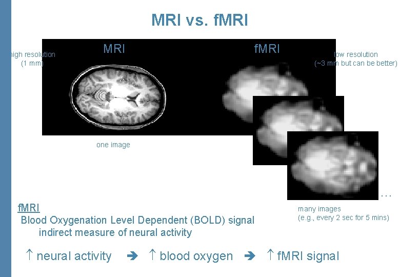 MRI vs. f. MRI high resolution (1 mm) MRI f. MRI low resolution (~3