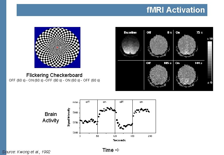 f. MRI Activation Flickering Checkerboard OFF (60 s) - ON (60 s) - OFF