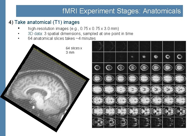 f. MRI Experiment Stages: Anatomicals 4) Take anatomical (T 1) images • high-resolution images