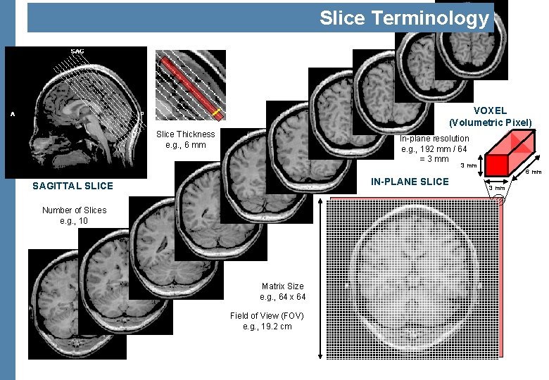 Slice Terminology VOXEL (Volumetric Pixel) Slice Thickness e. g. , 6 mm In-plane resolution