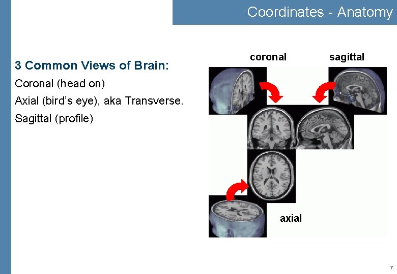 Coordinates - Anatomy 3 Common Views of Brain: coronal sagittal Coronal (head on) Axial