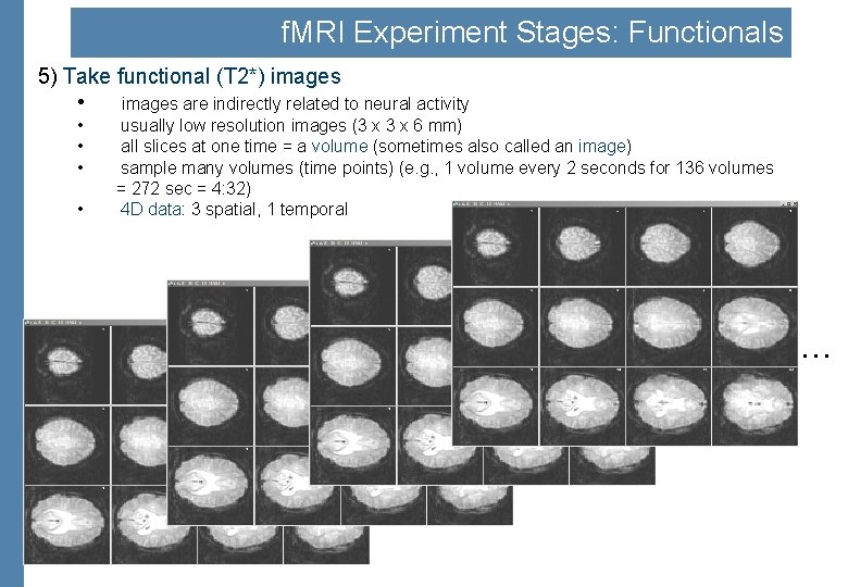 f. MRI Experiment Stages: Functionals 5) Take functional (T 2*) images • images are