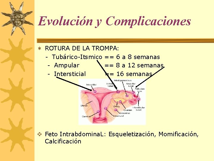 Evolución y Complicaciones ¬ ROTURA DE LA TROMPA: - Tubárico-Itsmico == 6 a 8