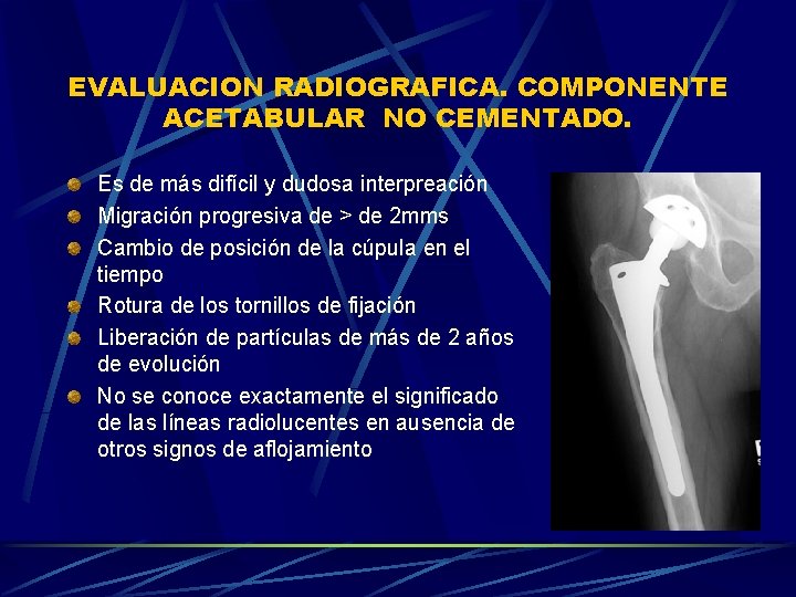 EVALUACION RADIOGRAFICA. COMPONENTE ACETABULAR NO CEMENTADO. Es de más difícil y dudosa interpreación Migración