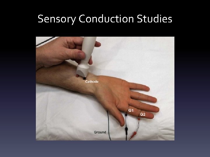 Sensory Conduction Studies Sensory Conduction Studies