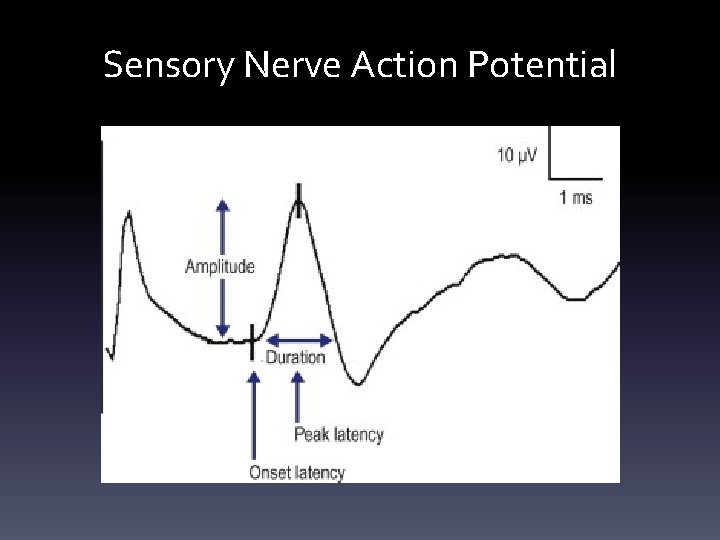 Sensory Nerve Action Potential Sensory Nerve Action Potential