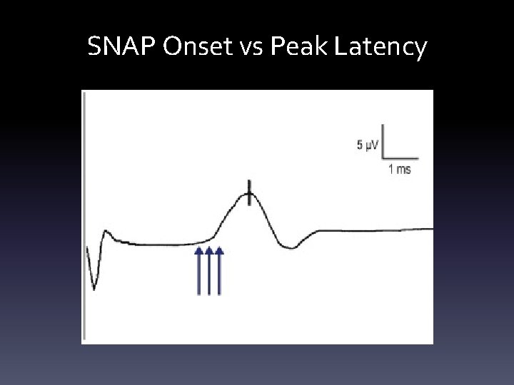 SNAP Onset vs Peak Latency SNAP Onset vs Peak Latency