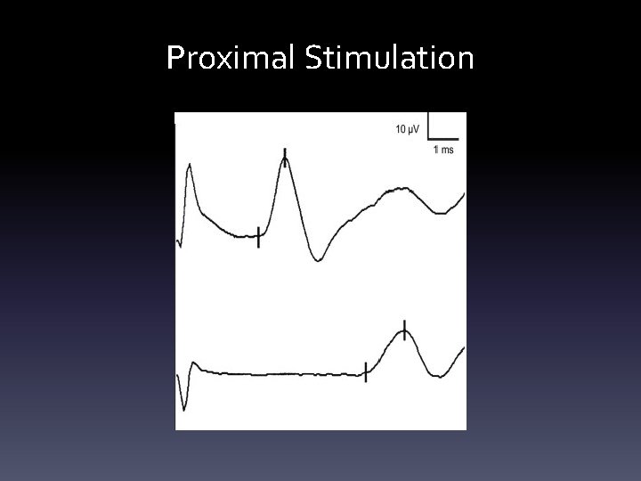 Proximal Stimulation Proximal Stimulation