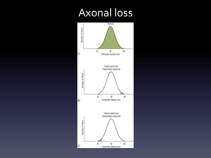 Axonal loss Axonal loss