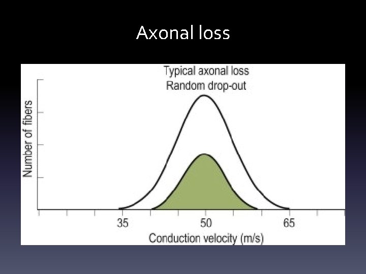 Axonal loss Axonal loss
