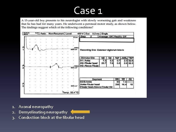Case 1 1. Axonal neuropathy 2. Demyelinating neuropathy 3. Conduction block at the fibular Case 1 1. Axonal neuropathy 2. Demyelinating neuropathy 3. Conduction block at the fibular
