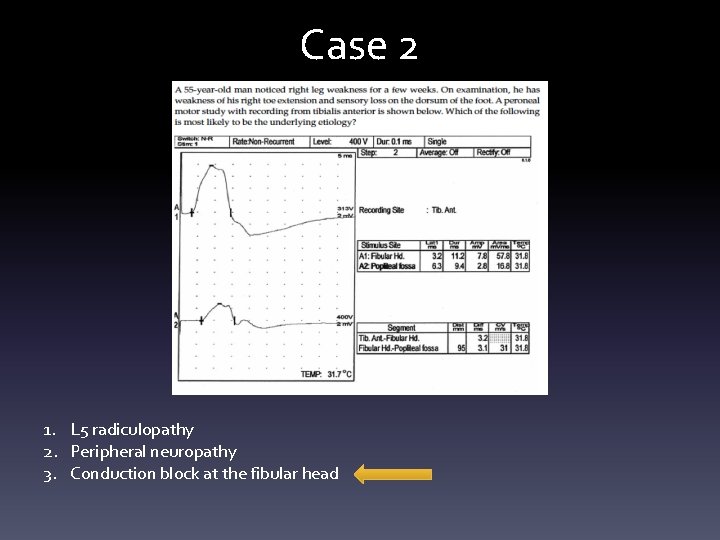 Case 2 1. L 5 radiculopathy 2. Peripheral neuropathy 3. Conduction block at the Case 2 1. L 5 radiculopathy 2. Peripheral neuropathy 3. Conduction block at the