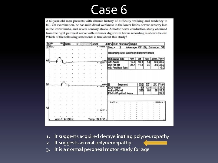 Case 6 1. It suggests acquired demyelinating polyneuropathy 2. It suggests axonal polyneuropathy 3. Case 6 1. It suggests acquired demyelinating polyneuropathy 2. It suggests axonal polyneuropathy 3.