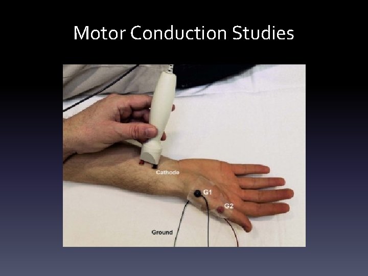 Motor Conduction Studies Motor Conduction Studies
