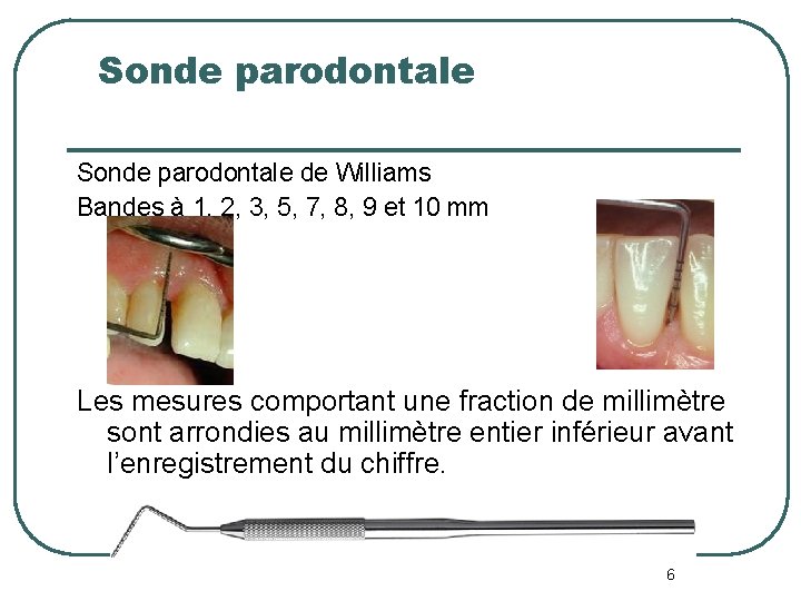 Sonde parodontale de Williams Bandes à 1, 2, 3, 5, 7, 8, 9 et