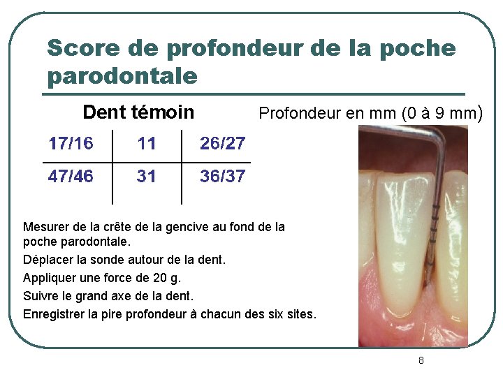 Score de profondeur de la poche parodontale Dent témoin Profondeur en mm (0 à