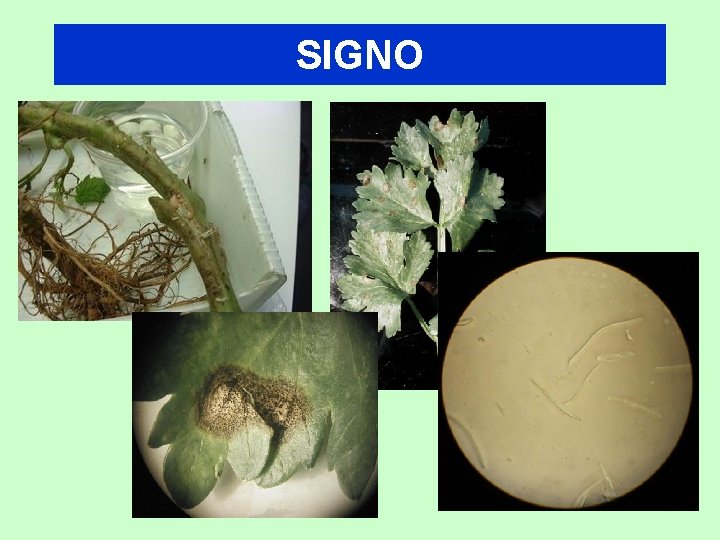 SIGNO 