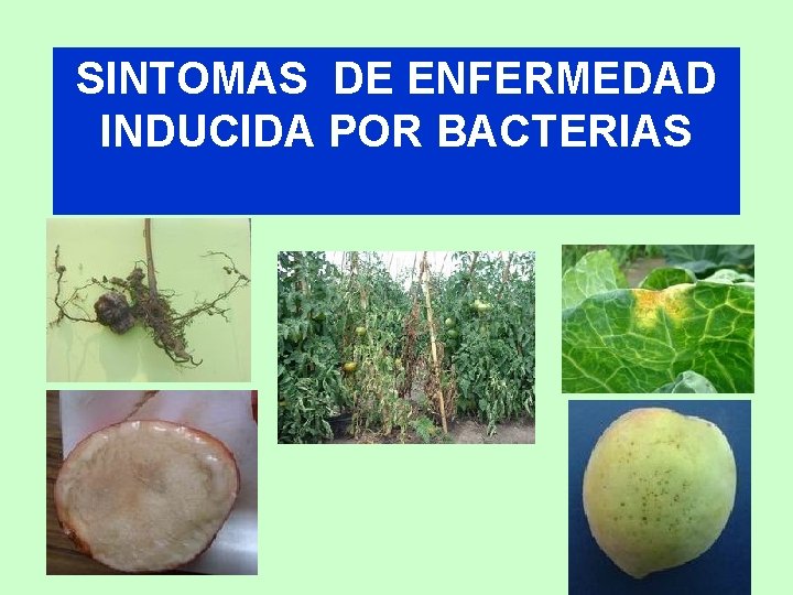 SINTOMAS DE ENFERMEDAD INDUCIDA POR BACTERIAS 