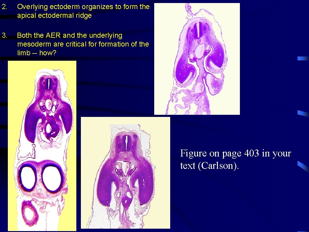 2. Overlying ectoderm organizes to form the apical ectodermal ridge 3. Both the AER