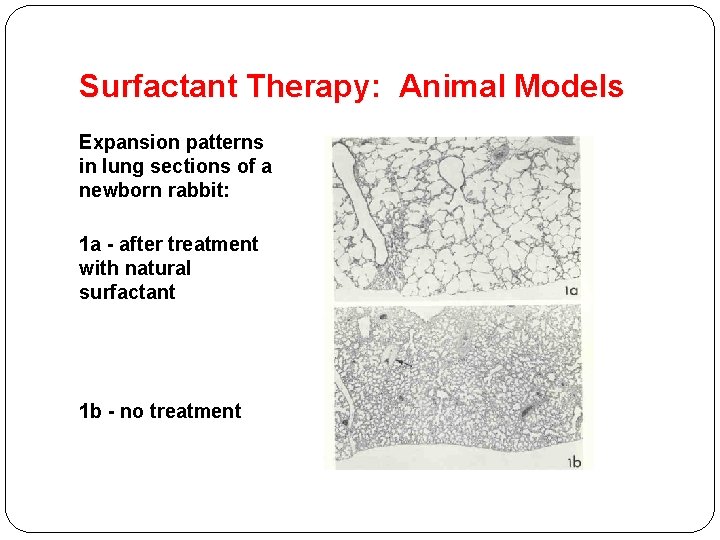 Surfactant Therapy: Animal Models Expansion patterns in lung sections of a newborn rabbit: 1