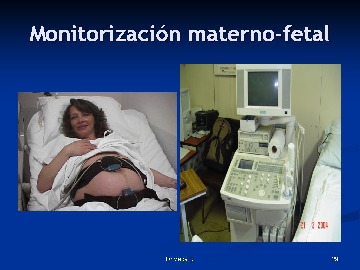 Monitorización materno-fetal Dr. Vega. R 29 