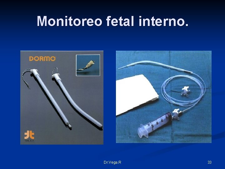 Monitoreo fetal interno. Dr. Vega. R 33 