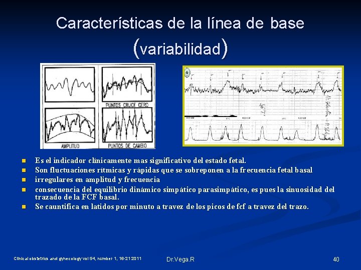 Características de la línea de base (variabilidad) n n n Es el indicador clínicamente