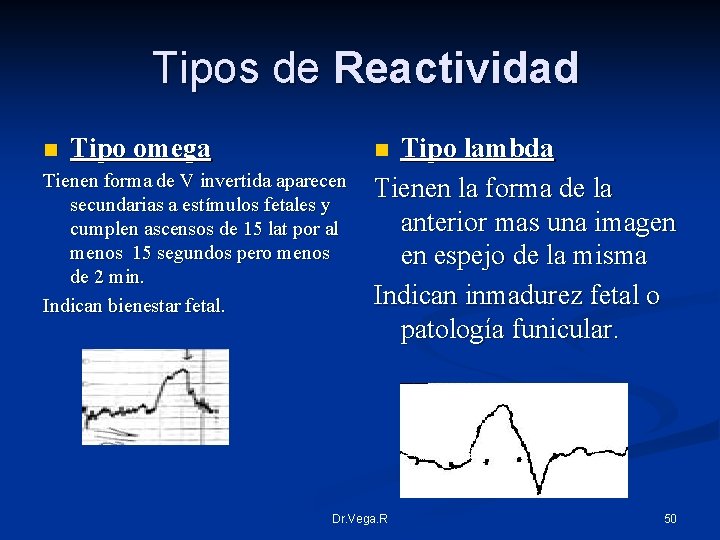 Tipos de Reactividad n Tipo omega Tienen forma de V invertida aparecen secundarias a