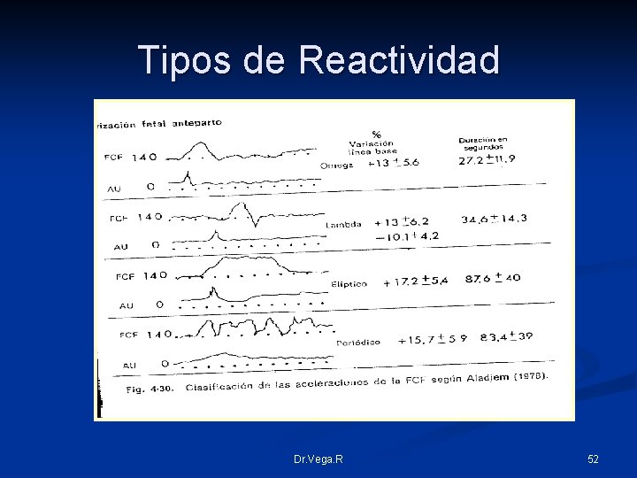Tipos de Reactividad Dr. Vega. R 52 