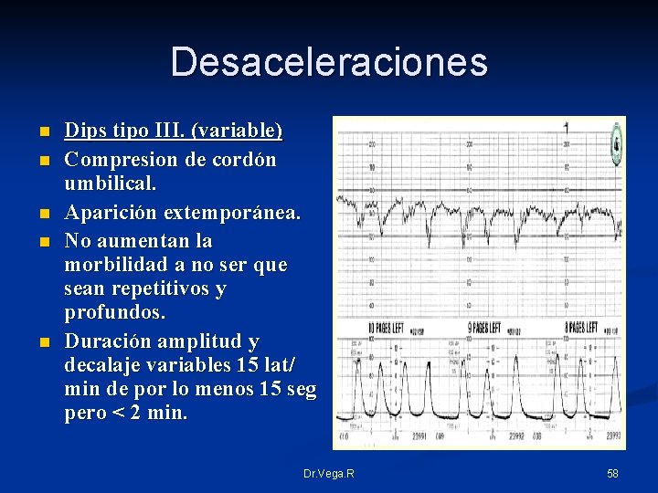 Desaceleraciones n n n Dips tipo III. (variable) Compresion de cordón umbilical. Aparición extemporánea.