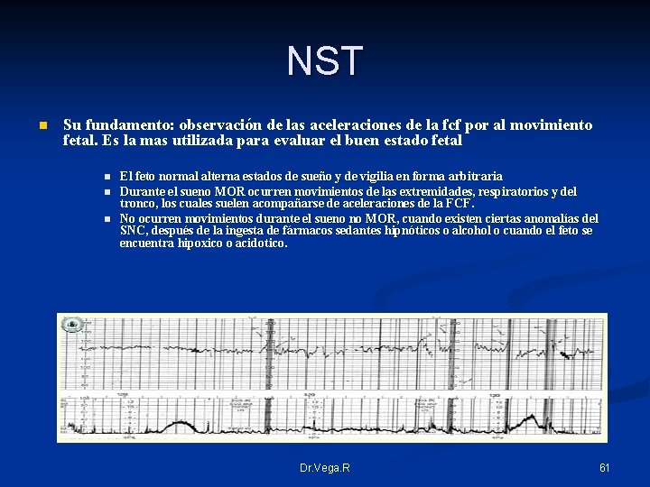 NST n Su fundamento: observación de las aceleraciones de la fcf por al movimiento