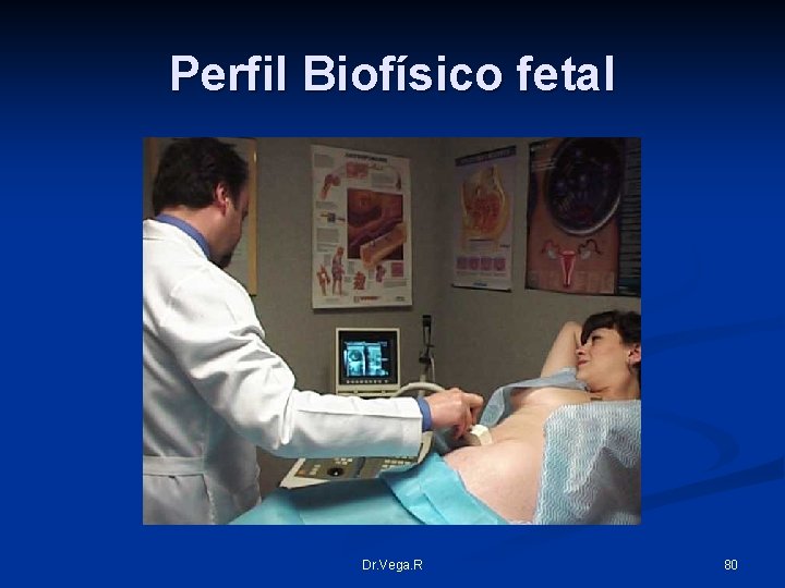 Perfil Biofísico fetal Dr. Vega. R 80 