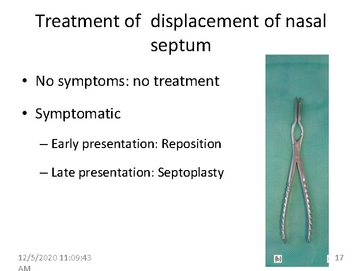 Treatment of displacement of nasal septum • No symptoms: no treatment • Symptomatic –