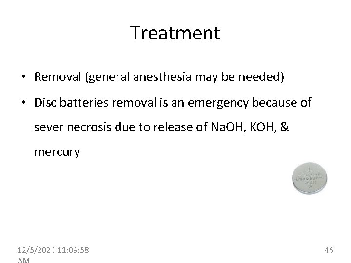 Treatment • Removal (general anesthesia may be needed) • Disc batteries removal is an