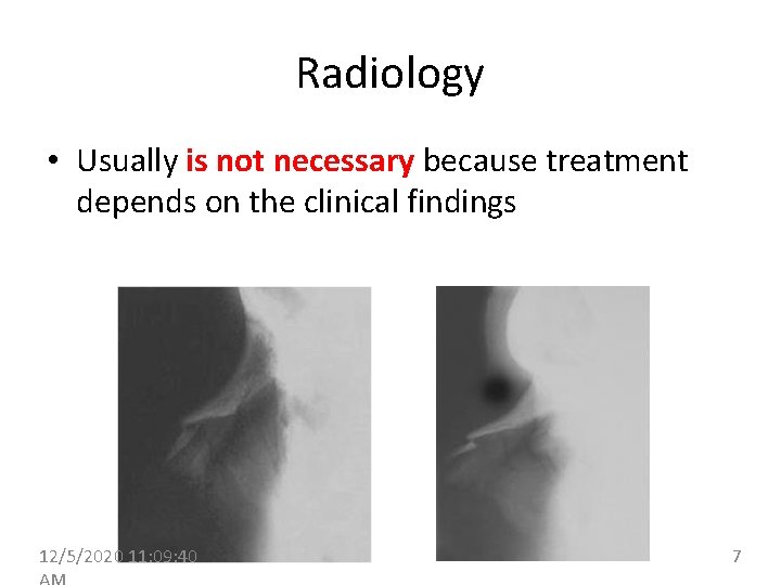 Radiology • Usually is not necessary because treatment depends on the clinical findings 12/5/2020