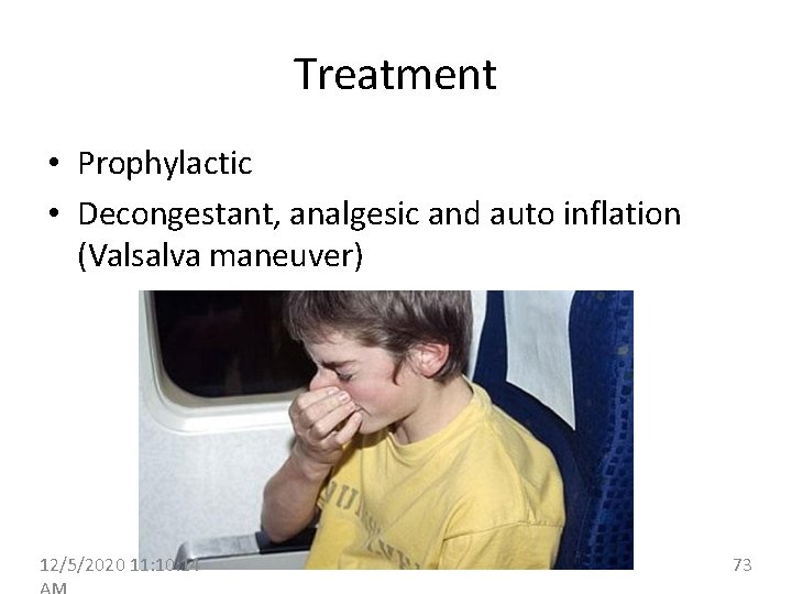 Treatment • Prophylactic • Decongestant, analgesic and auto inflation (Valsalva maneuver) 12/5/2020 11: 10: