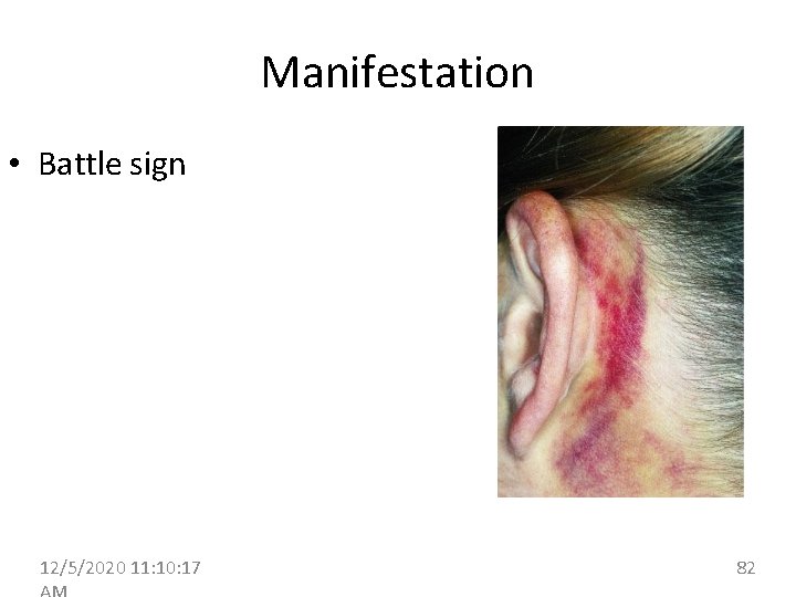 Manifestation • Battle sign 12/5/2020 11: 10: 17 82 