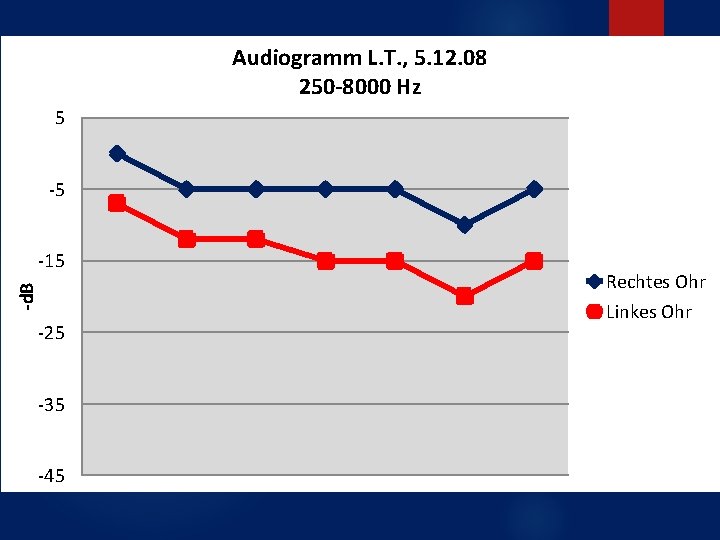 Audiogramm L. T. , 5. 12. 08 250 -8000 Hz 5 -5 -d. B