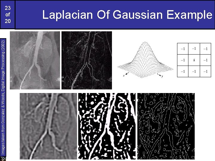 Images taken from Gonzalez & Woods, Digital Image Processing (2002) 23 of 20 Laplacian