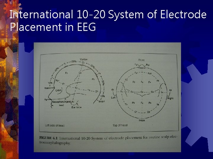 International 10 -20 System of Electrode Placement in EEG 