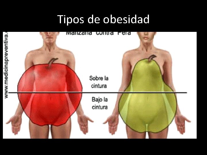 Tipos de obesidad 