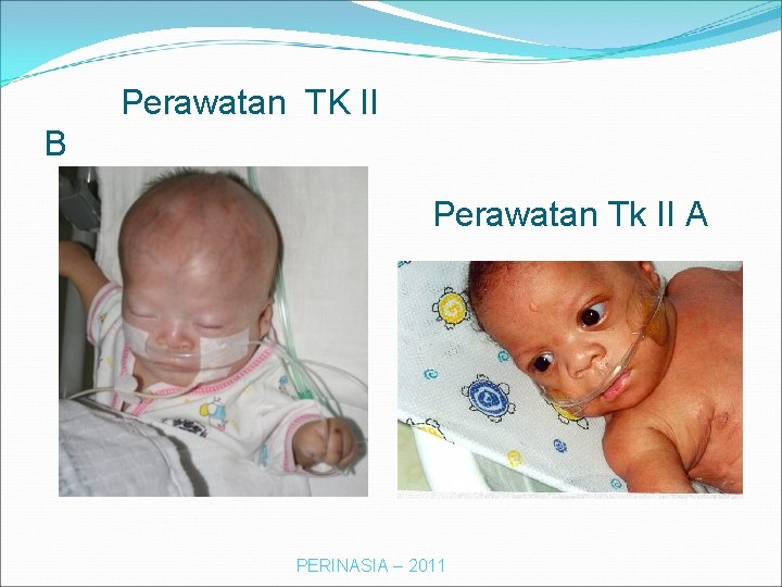 Perawatan TK II B Perawatan Tk II A PERINASIA – 2011 