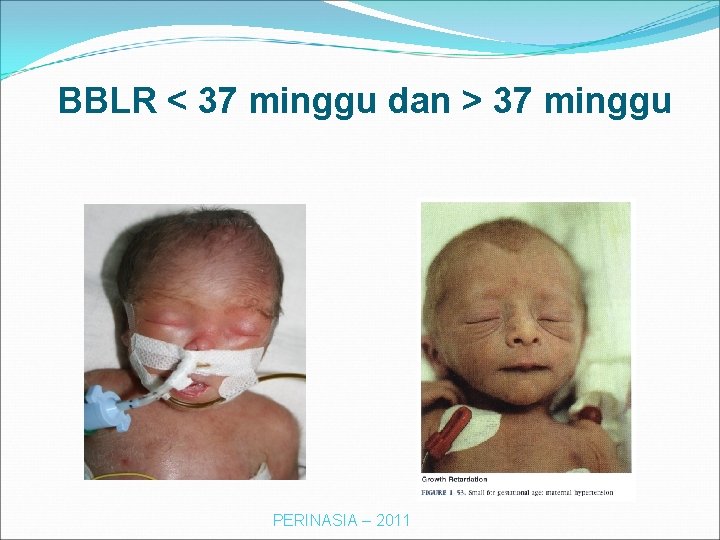 BBLR < 37 minggu dan > 37 minggu PERINASIA – 2011 